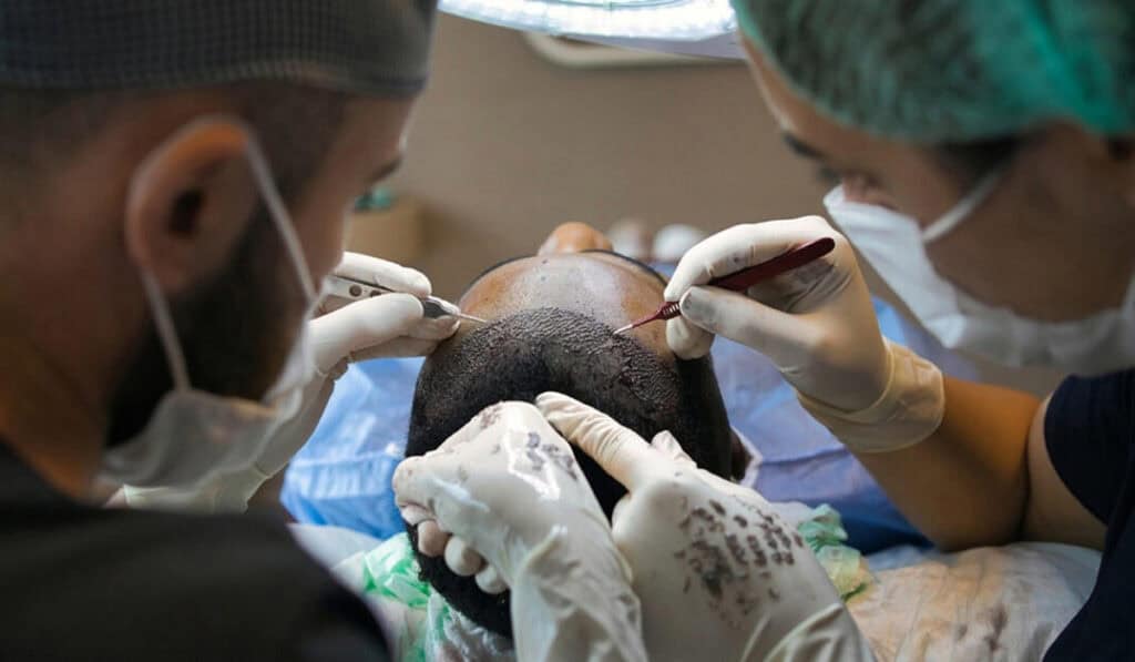 hairtransplant